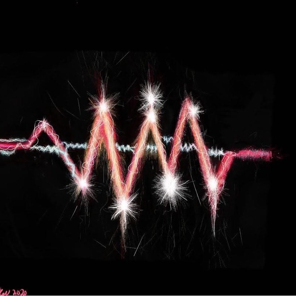 “An electric start to a heart beating in love”